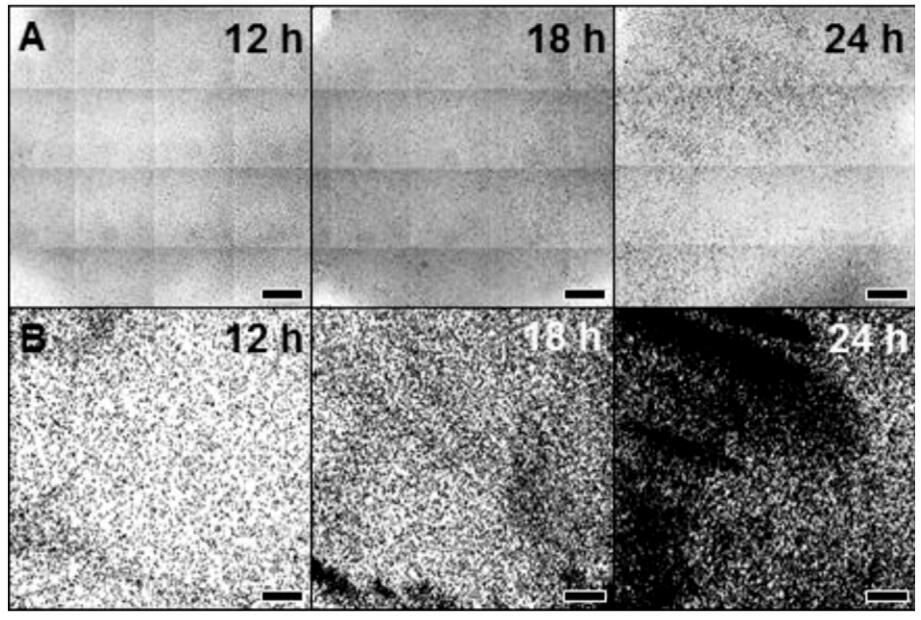 應(yīng)用細(xì)胞成像分析裝置評價(jià)黃芩甙元、殼聚糖和念珠菌和地衣酸對假絲酵母菌和克魯斯假絲酵母菌中生物膜的影響
