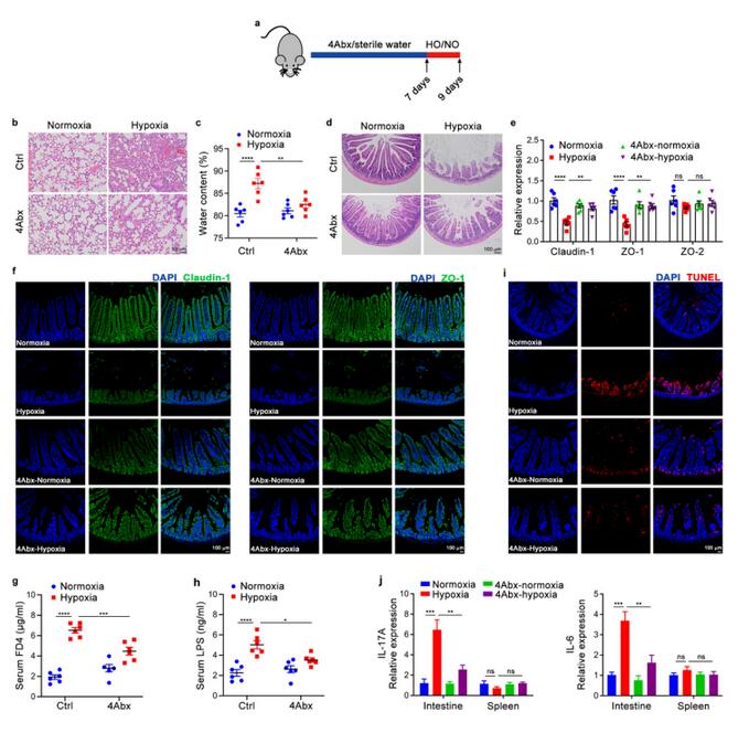 腸道微生物群的磷脂代謝產(chǎn)物可促進缺氧誘導的腸道損傷