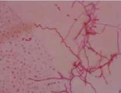 Act0988放線菌拮抗菌株的鑒定、培養(yǎng)條件與菌株生長關系、發(fā)酵工藝（一）