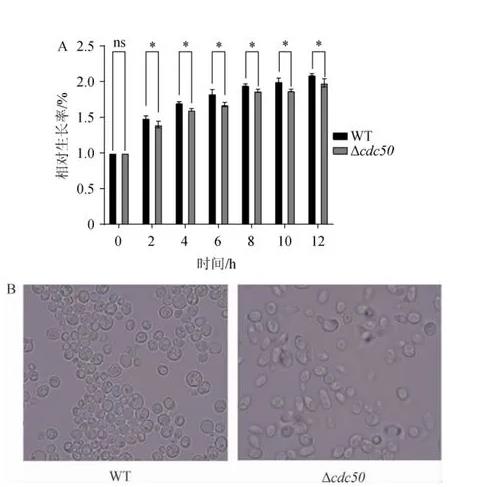 ?釀酒酵母細胞cdc50基因的生物學作用及生長曲線
