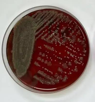 我國(guó)鹽堿土壤中細(xì)菌有哪些？如何分布的