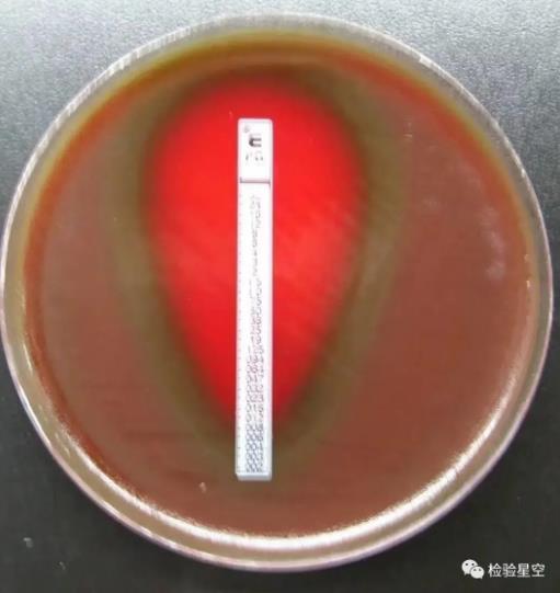 檢驗(yàn)科微生物室細(xì)菌鑒定常見菌株形態(tài)特征、培養(yǎng)鑒別、臨床表現(xiàn)及天然耐藥