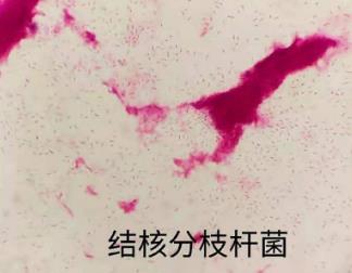 分枝桿菌在貓、狗、鳥中的流行和傳播途徑