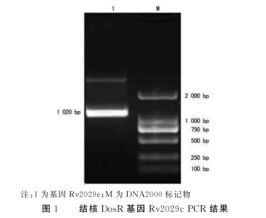 結(jié)核分枝桿菌蛋白Rv2029c促進(jìn)大腸埃希菌生長及糖酵解能力——摘要、材料與方法