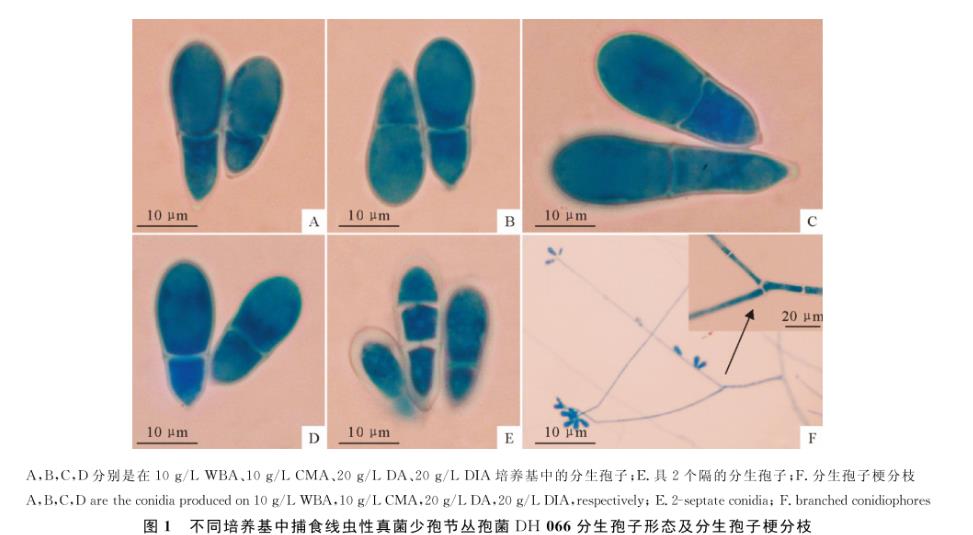 捕食線(xiàn)蟲(chóng)性真菌少孢節(jié)叢孢菌不同分離株在4種培養(yǎng)基的生長(zhǎng)速度研究（一）