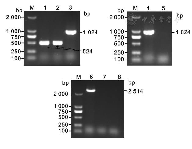 肺炎克雷伯菌vgrG基因缺失株構(gòu)建、體外生長能力測定（一）