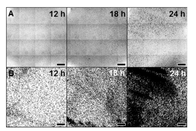 全自動微生物生長曲線分析儀應(yīng)用：黃芩素與殼聚糖抑制酵母生物膜研究（一）
